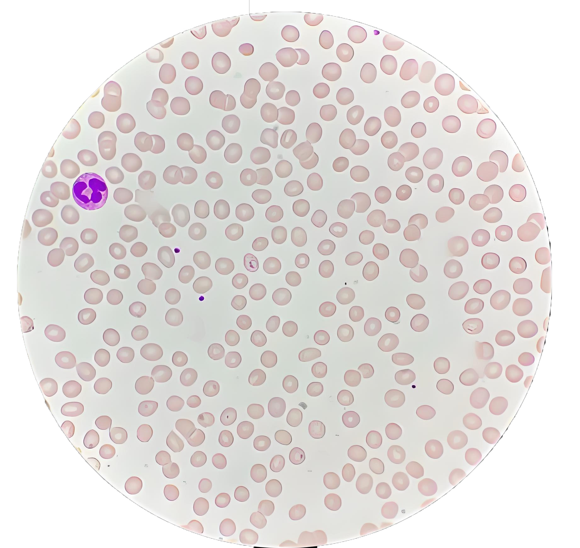 寄生蟲(chóng)檢測(cè)系列